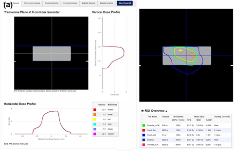 Mobius3d Chart 방사선의학 웹진